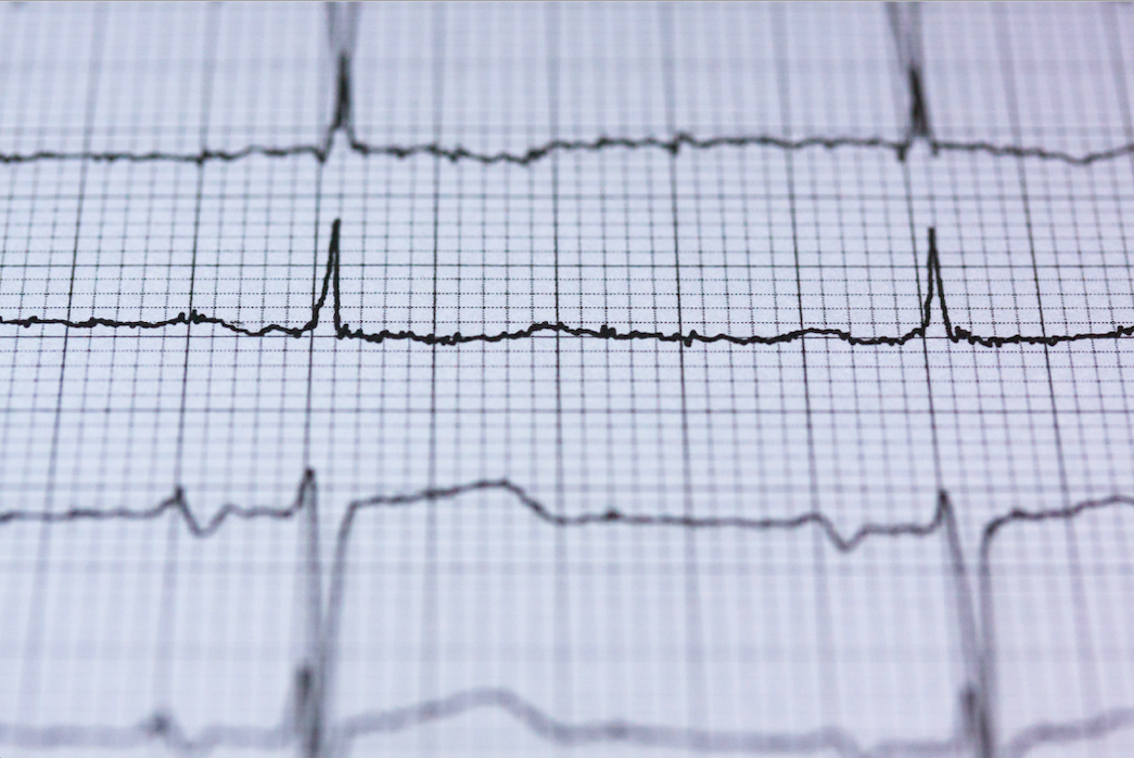 Telecardiología